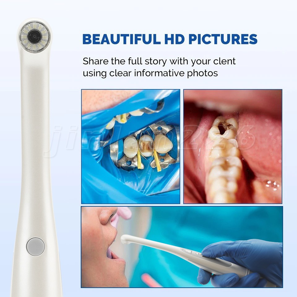 USB Dental Intraoral Oral Camera 1/4 sony CCD Fit TWAIN