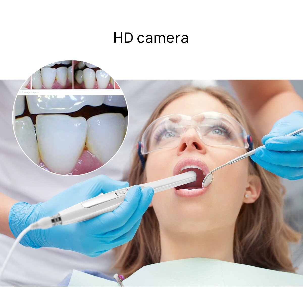 AZDENT Dental USB Imaging Intraoral Camera 6LED Auto-Focus Digital Endoscope