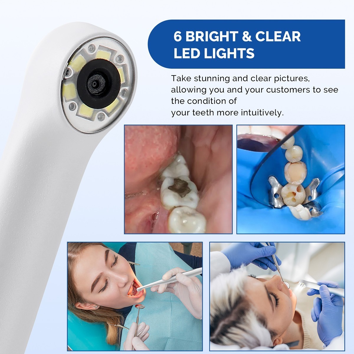 Azdent Dental Intraoral Camera Digital Imaging Focus Intra Oral 6 LED Light US
