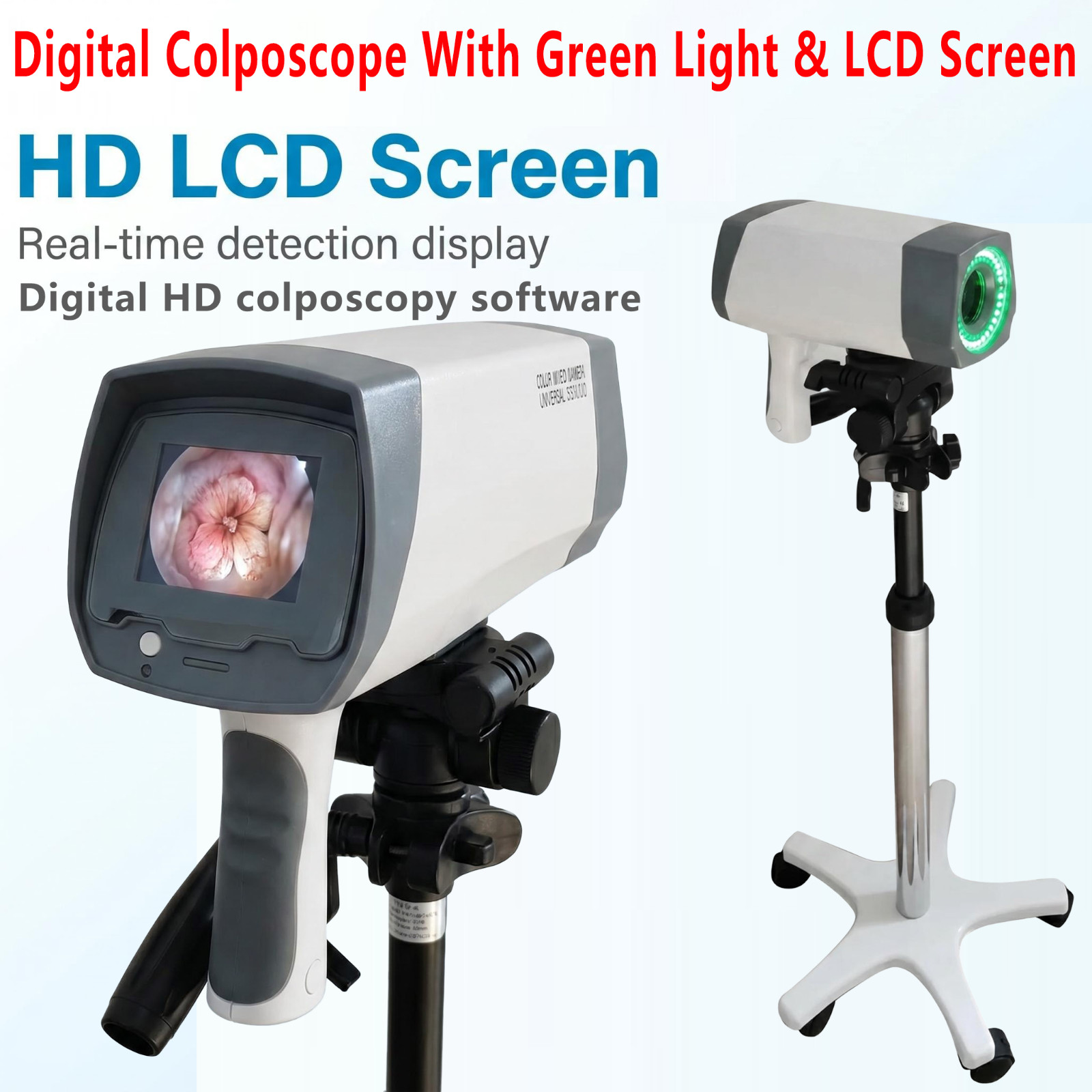 HD Digital Colposcope Green LED LCD Gynecology Exam Tool Including software