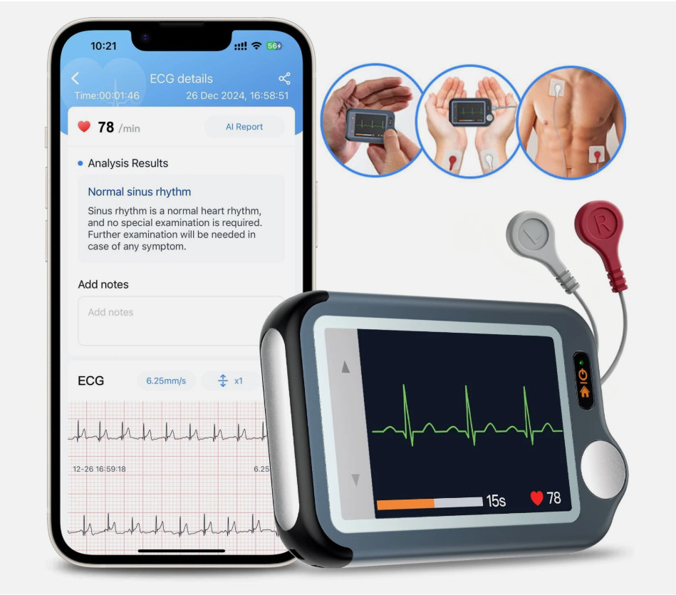 2026 New EKG Monitor Bluetooth Heart Monitor 30s/60s/5min Recording+AI Analysis