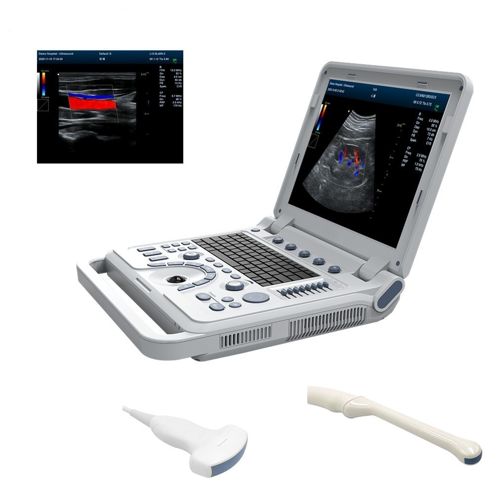 Portable Ultrasound Scanner Color Doppler Laptop Machine Convex TransVaginal CF