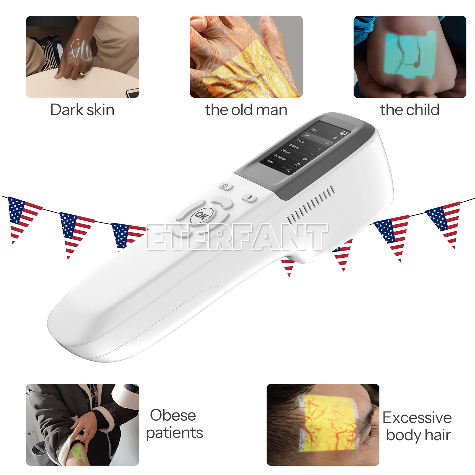 QV-600 Vein Finder Locator Handheld Portable Near-Infrared Blood Vessel Display