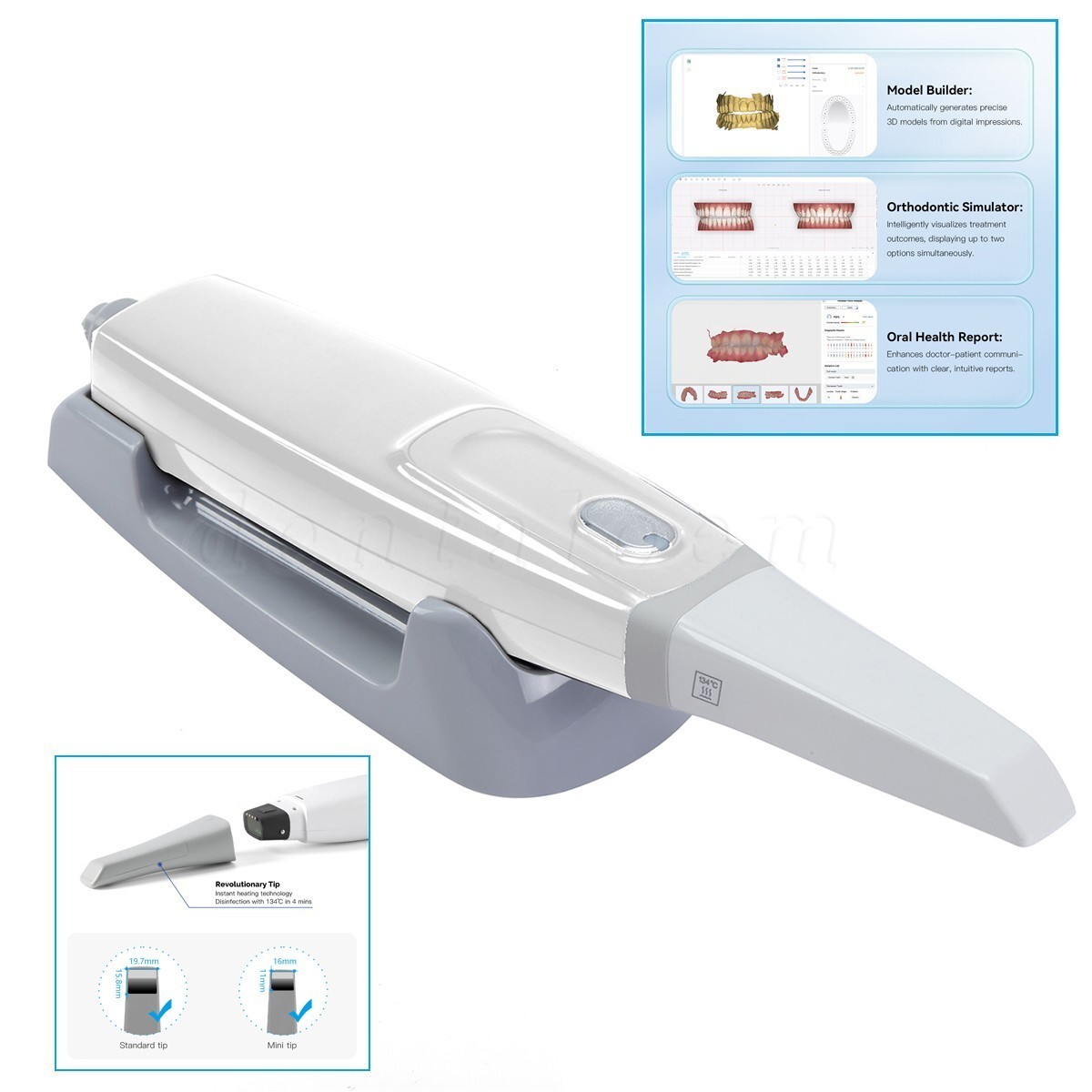 Dental Intraoral Scanner for CAD/CAM Restorative Dentistry